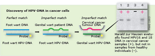 manbet手机版在癌细胞中发现HPV-DNA