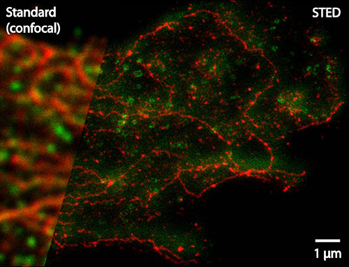 manbet手机版胶质母细胞瘤的双色STED图像。manbet手机版Â©J. BÃ¼kers, D. Wildanger, L. Kastrup, R. Medda