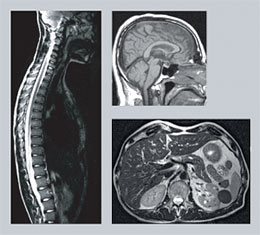 manbet手机版大脑和脊髓的成像